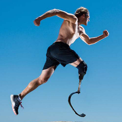 合肥假肢厂液压大腿假肢是如何让患者健步如飞