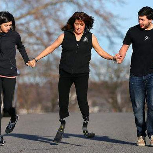 露出假肢，做骄傲的残疾人！