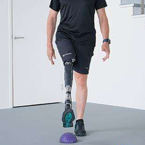 大腿截肢患者装配假肢前有必要做康复训练吗？