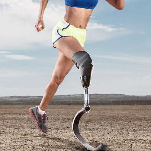 安徽合肥 80%假肢患者夏天必遇的残肢问题