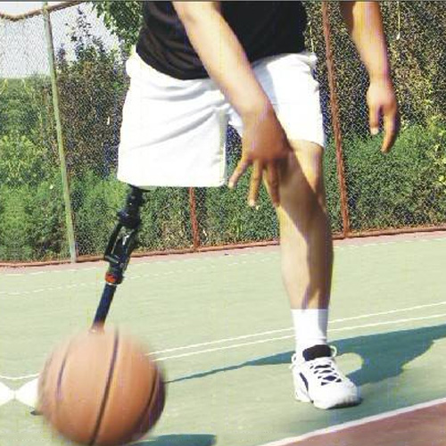安徽假肢厂安装大腿假肢有什么建议？